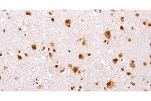 Immunohistochemistry of paraffin-embedded Human brain tissue using TBX2 Polyclonal Antibody at dilution 1:32 (TBX2 anticorps)