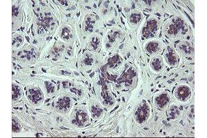 Immunohistochemical staining of paraffin-embedded Human breast tissue using anti-SCFD1 mouse monoclonal antibody. (SCFD1 anticorps)