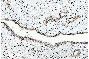 IHC analysis of CTBP2 using anti-CTBP2 antibody (ABIN7601325). (CTBP2 anticorps  (AA 321-445))