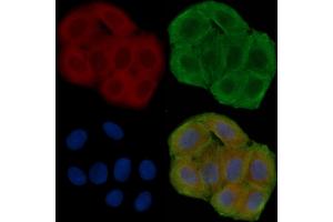 ABIN6258193 and ABIN6276039 staining Hela cells(30 min of UV treatment) by IF/ICC.