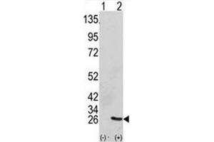Western blot analysis of GRB2 antibody and 293 cell lysate (2 ug/lane) either nontransfected (Lane 1) or transiently transfected with the GRB2 gene (2). (GRB2 anticorps  (AA 89-118))