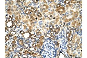 C3orf31 antibody was used for immunohistochemistry at a concentration of 4-8 ug/ml to stain Epithelial cells of renal tubule (arrows) in Human Kidney. (TAM41 anticorps  (N-Term))