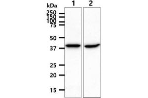 The cell lysate (40ug) were resolved by SDS-PAGE, transferred to PVDF membrane and probed with anti-human ACADS antibody (1:1000).