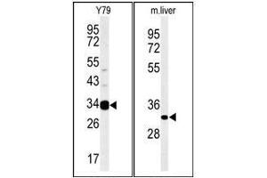 Western blot analysis: AIG1 Antibody staining of Mouse liver tissue lysates (Right) and Y79 cell line lysates (Left) (35 ug/lane). (AIG1 anticorps  (N-Term))