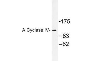 Image no. 1 for anti-Adenylate Cyclase 4 (ADCY4) antibody (ABIN317941) (ADCY4 anticorps)