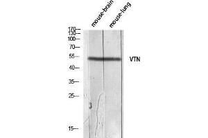 Western Blot (WB) analysis of Mouse Brain Mouse Lung lysis using VTN antibody. (Vitronectin anticorps)