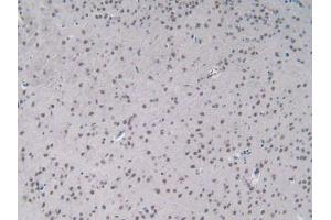 IHC-P analysis of Mouse Brain Tissue, with DAB staining. (IL-2 anticorps  (AA 10-169))