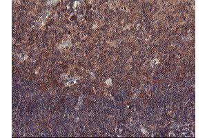 Image no. 3 for anti-Prefoldin Subunit 3 (PFDN3) antibody (ABIN1501705)