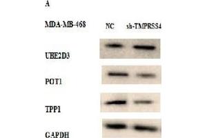 Western Blot Analysis was Performed to Study the Effect of TMPRSS4 Expression Modulation on Telomere Integrity in Stably Transfected MDA-MB-468 and MCF-7 Cell Lines by Analyzing the Expression of Certain Proteins Related to Telomere Maintenance (UBE2D3, POT1, and TPP1). (TPP1 anticorps  (AA 284-563))