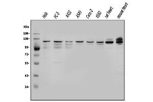 Western blot analysis of OGT using anti-OGT antibody (ABIN3043893). (OGT anticorps  (C-Term))