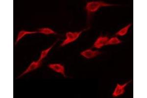 ABIN6274939 staining NIH-3T3 by IF/ICC. (CAPN12 anticorps  (Internal Region))