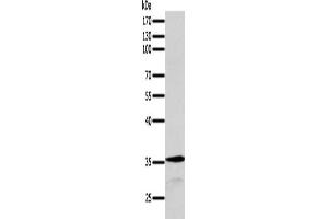 Gel: 10 % SDS-PAGE, Lysate: 40 μg, Lane: MCF7 cells, Primary antibody: ABIN7131278(SYT9 Antibody) at dilution 1/200, Secondary antibody: Goat anti rabbit IgG at 1/8000 dilution, Exposure time: 1 minute (SYT9 anticorps)
