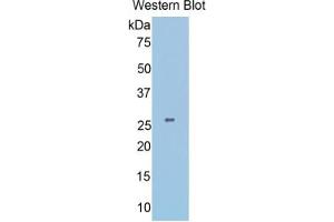 WB of Protein Standard: different control antibodies against Highly purified E.