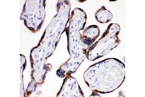 IHC analysis of AEBP2 using anti-AEBP2 antibody (ABIN4886435). (AEBP2 anticorps  (AA 424-517))