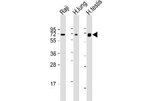 All lanes : Anti-ERVK-7 Antibody (N-Term) at 1:1000-1:2000 dilution Lane 1: Raji whole cell lysate Lane 2: human lung lysate Lane 3: human testis lysate Lysates/proteins at 20 μg per lane. (ERVK-7 anticorps  (AA 96-128))