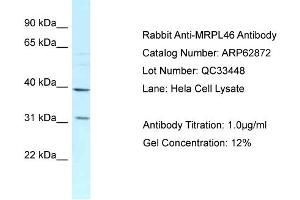 Western Blotting (WB) image for anti-Mitochondrial Ribosomal Protein L46 (MRPL46) (C-Term) antibody (ABIN2789278) (MRPL46 anticorps  (C-Term))