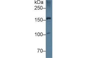 Western Blot; Sample: Rat Liver lysate; Primary Ab: 5µg/ml Mouse Anti-Rat APOB Antibody Second Ab: 0.