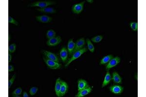 Immunofluorescent analysis of HepG2 cells using ABIN7170251 at dilution of 1:100 and Alexa Fluor 488-congugated AffiniPure Goat Anti-Rabbit IgG(H+L)