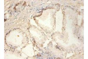 Immunohistochemistry of paraffin-embedded human prostate tissue using ABIN7163321 at dilution of 1:100