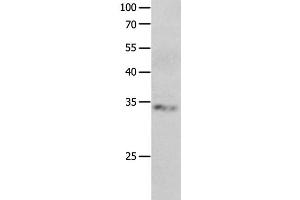 Western Blot analysis of Jurkat cell using RBFOX3 Polyclonal Antibody at dilution of 1:550 (NeuN anticorps)