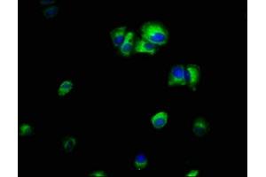 Immunofluorescence staining of MCF-7 cells with ABIN7156505 at 1:66, counter-stained with DAPI. (ILK anticorps  (AA 1-228))