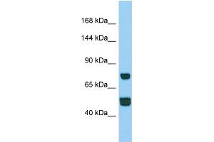 Western Blotting (WB) image for anti-Coiled-Coil Domain Containing 39 (CCDC39) (N-Term) antibody (ABIN2790737) (CCDC39 anticorps  (N-Term))