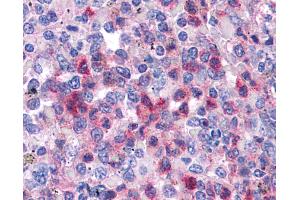 Anti-SGK3 antibody IHC of human spleen.