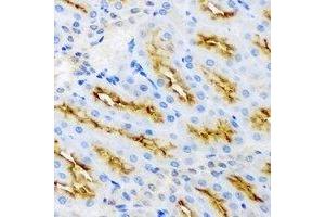 Immunohistochemistry (IHC) image for anti-Protein Kinase, AMP-Activated, beta 2 Non-Catalytic Subunit (PRKAB2) antibody (ABIN7308228)