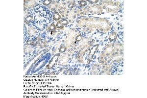 Human kidney (EZH2 anticorps  (N-Term))