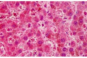 Human Liver: Formalin-Fixed, Paraffin-Embedded (FFPE) (RNF2 anticorps  (AA 189-201))