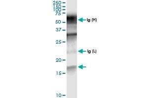 Immunoprecipitation of PTS transfected lysate using anti-PTS MaxPab rabbit polyclonal antibody and Protein A Magnetic Bead , and immunoblotted with PTS MaxPab rabbit polyclonal antibody (D01) .
