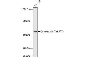 Western blot analysis of extracts of HepG2 cells, using Cytokeratin 7 (KRT7) antibody (ABIN6129292, ABIN6143037, ABIN6143039 and ABIN6215559) at 1:1000 dilution.