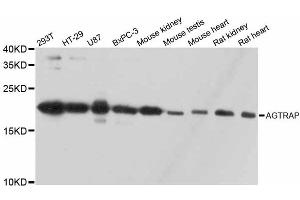 Western blot analysis of extracts of various cell lines, using AGTRAP antibody. (AGTRAP anticorps)