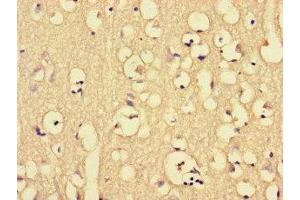 Immunohistochemistry of paraffin-embedded human brain tissue using ABIN7149360 at dilution of 1:100 (CKAP2L anticorps  (AA 246-413))