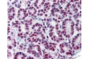 Immunohistochemistry (IHC) image for anti-Signal Transducer and Activator of Transcription 5A (STAT5A) (Tyr694) antibody (ABIN400812) (STAT5A anticorps  (Tyr694))