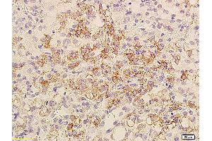 Formalin-fixed and paraffin embedded mouse transplant lymphoma labeled with Anti-Bcl-xL/BCL2L1/bcl-xs, Unconjugated (ABIN675129) at 1:800, followed by conjugation to the secondary antibody and DAB staining. (BCL2L1 anticorps  (AA 81-200))