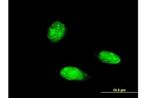 Immunofluorescence of monoclonal antibody to TRIM46 on HeLa cell. (TRIM46 anticorps  (AA 451-560))