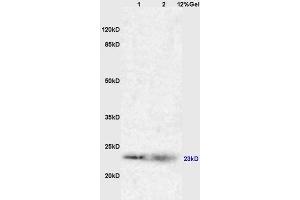 Lane 1: mouse liver lysates Lane 2: myeloma cell sp-20 lysates probed with Anti RAB7 Polyclonal Antibody, Unconjugated (ABIN720191) at 1:200 in 4 °C.