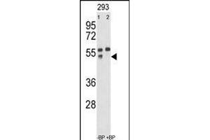 Western blot analysis of anti-hP12- Pab (ABIN390136 and ABIN2840640) pre-incubated without(lane 1) and with(lane 2) blocking peptide in 293 cell line lysate.
