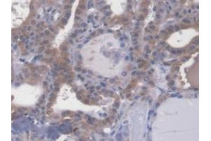 #VALUE! (Esophageal Cancer Related Gene 4 (AA 32-148) anticorps)