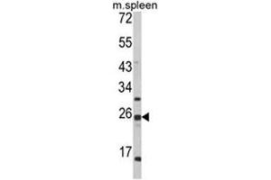 Western blot analysis of FKBP11 Antibody (C-term) in mouse spleen tissue lysates (35ug/lane). (FKBP11 anticorps  (C-Term))