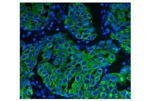 IF analysis of Cytokeratin 8 using anti-Cytokeratin 8 antibody (ABIN6719478). (KRT8 anticorps  (AA 107-325))