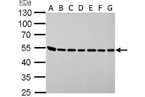 WB Image ASL antibody detects ASL protein by Western blot analysis.