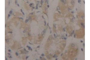 Detection of CK17 in Human Stomach Tissue using Polyclonal Antibody to Cytokeratin 17 (CK17)
