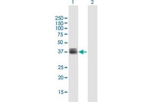Western Blot analysis of WISP3 expression in transfected 293T cell line by WISP3 MaxPab polyclonal antibody. (WISP3 anticorps  (AA 1-372))