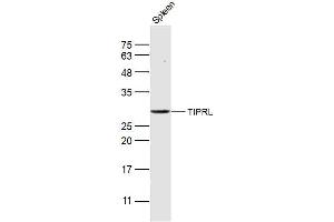Mouse spleen lysates probed with TIPRL Polyclonal Antibody, Unconjugated  at 1:300 dilution and 4˚C overnight incubation. (TIPRL anticorps  (AA 51-150))
