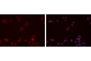 ABIN6273472 staining Hela cells by IF/ICC. (CX3CR1 anticorps  (N-Term))