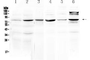 Western blot analysis of HSD17B4 using anti- HSD17B4 antibody .