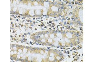 Immunohistochemistry of paraffin-embedded Human colon using SERPINA6 Polyclonal Antibody at dilution of 1:100 (40x lens).