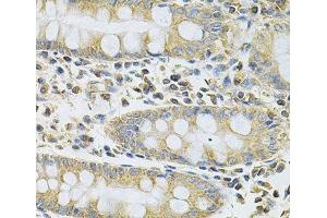 Immunohistochemistry of paraffin-embedded Human colon using SERPINA6 Polyclonal Antibody at dilution of 1:100 (40x lens). (SERPINA6 anticorps)